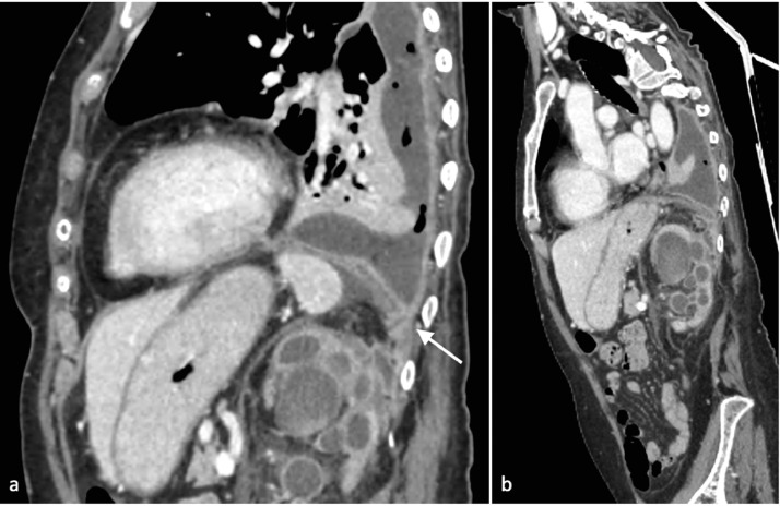 Fig 2 -