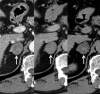 Figure 14.