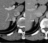 Figure 12.