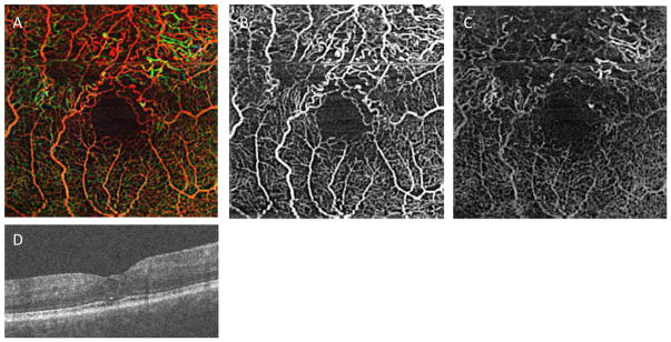 Figure 11