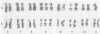 379