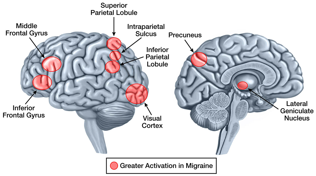 Figure 3: