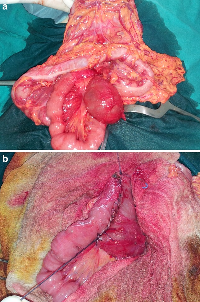 Fig. 4