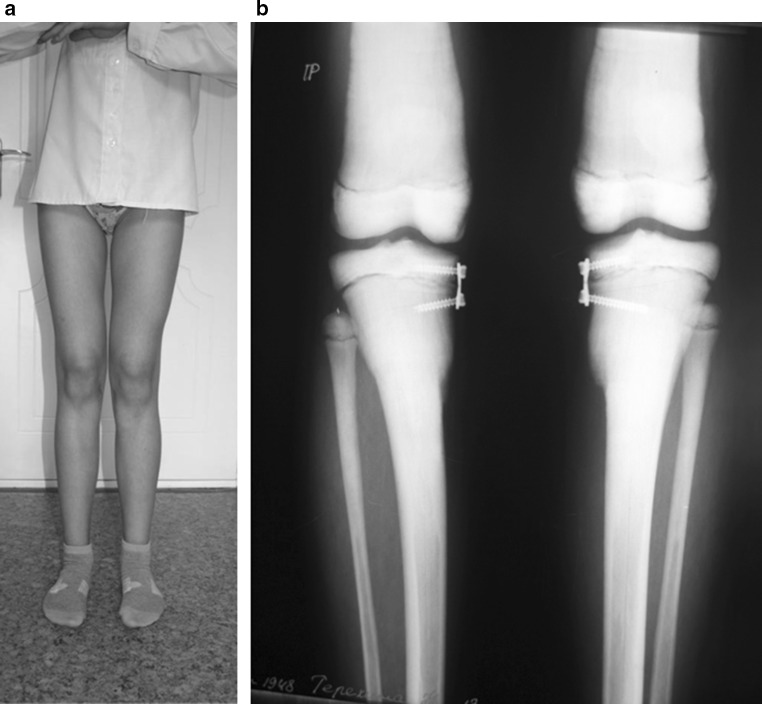 Fig. 3