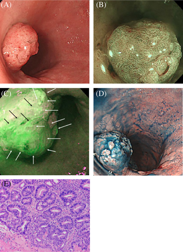 FIGURE 3