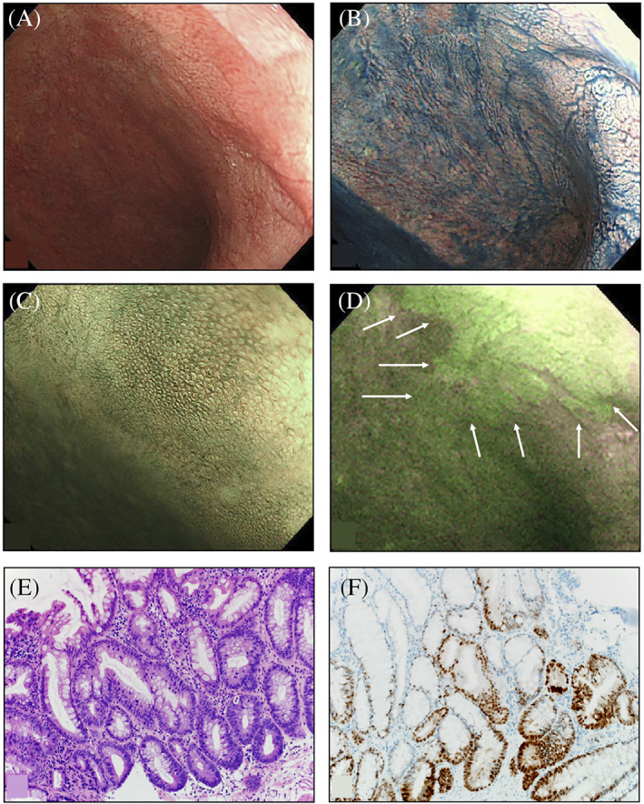 FIGURE 4