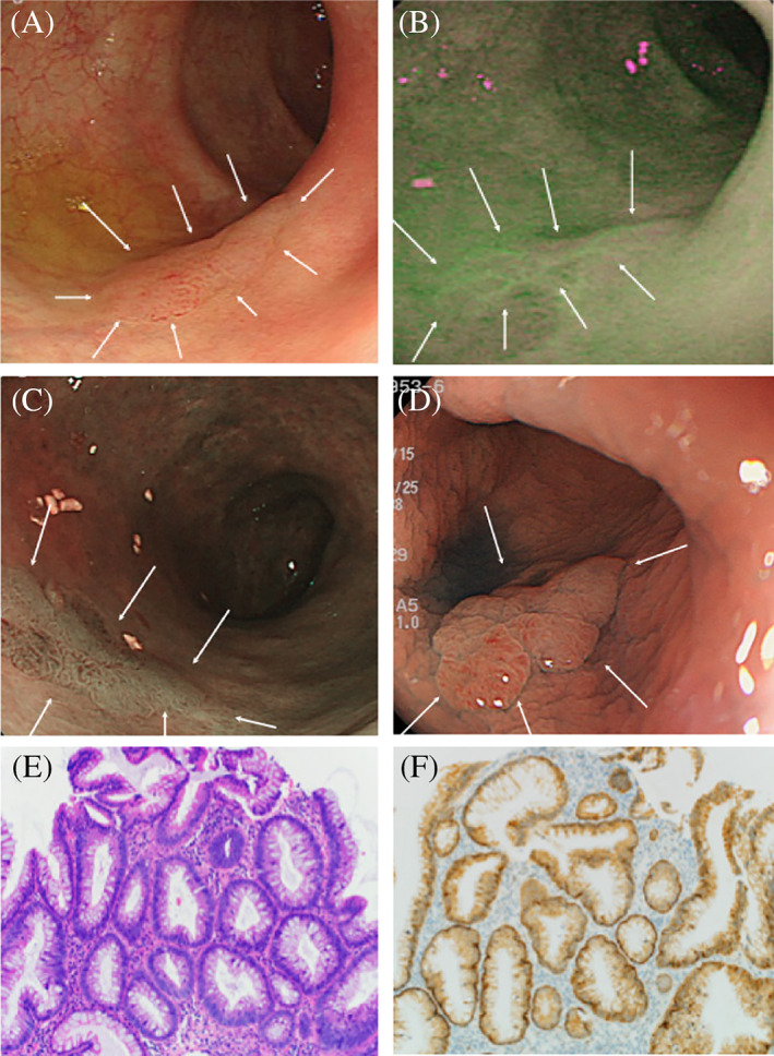 FIGURE 2