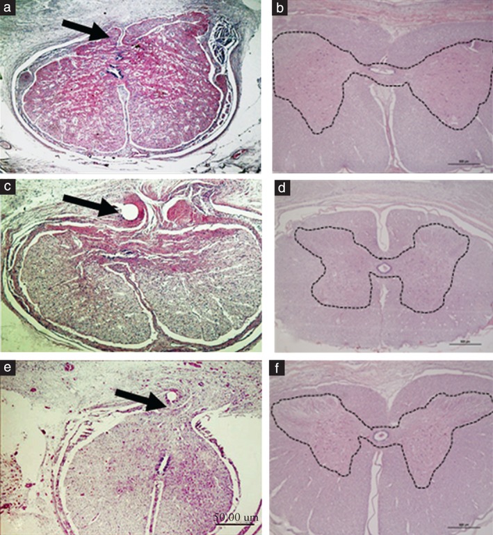 UOG-15987-FIG-0002-c