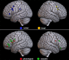Activity peaks for verbal vs visual RI, and phonological vs semantic RI displayed on brain renders