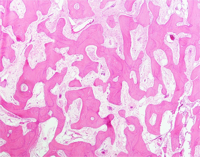 Fig. 14
