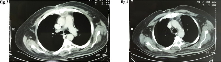 Figs. 3 and 4