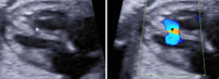 Figure 8