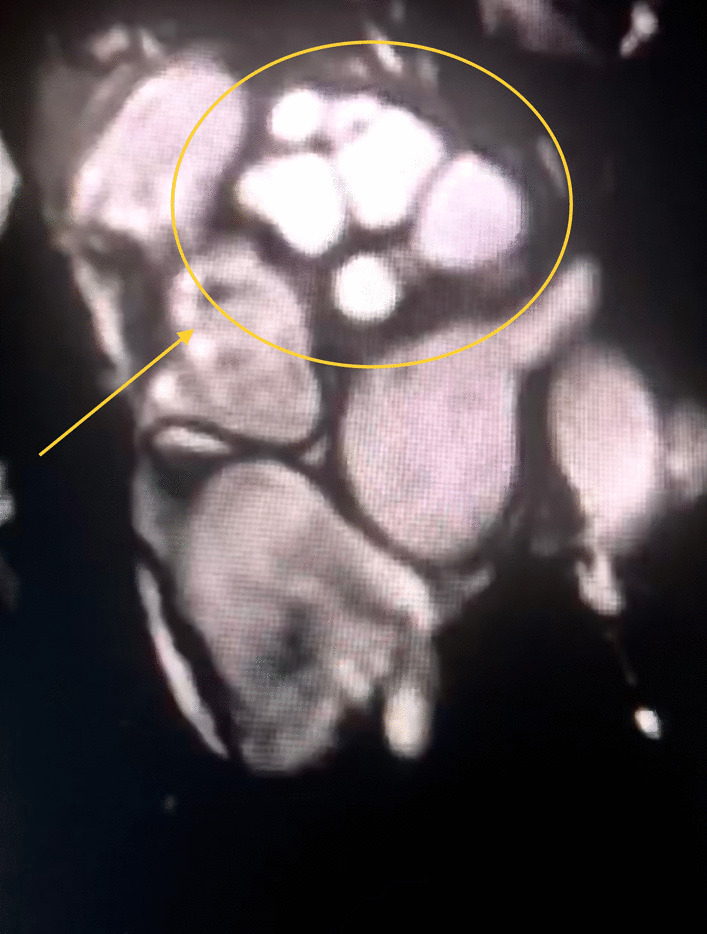 Fig. 2