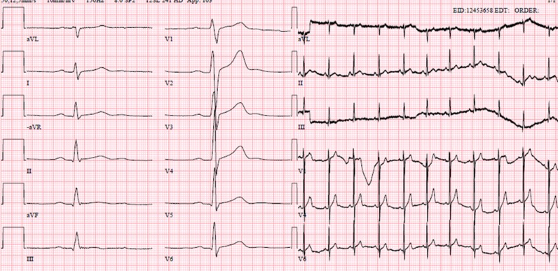 Figure 5: