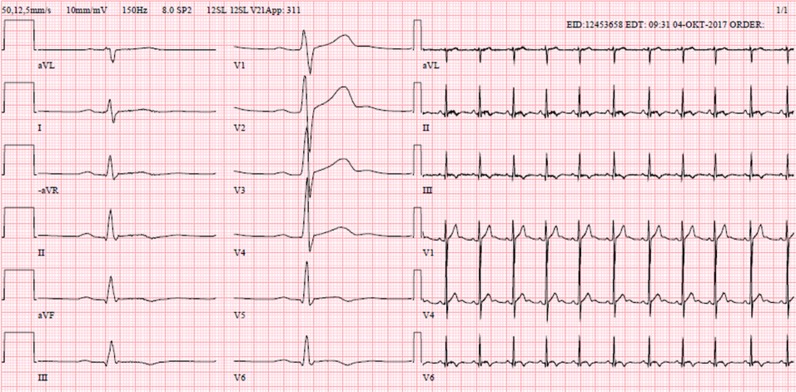 Figure 4: