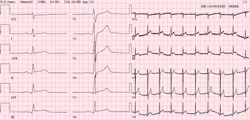 Figure 2: