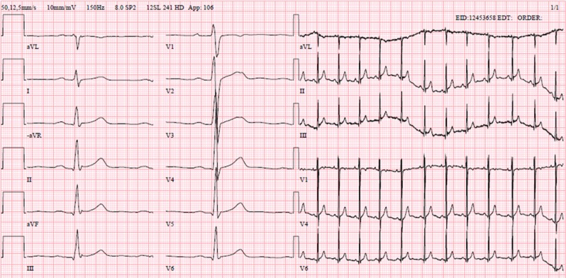 Figure 1: