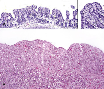 Figure 7-166