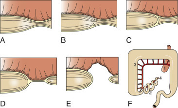 Figure 7-92
