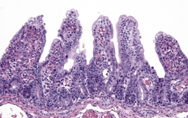 Figure 7-115