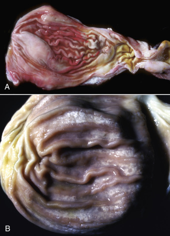 Figure 7-85