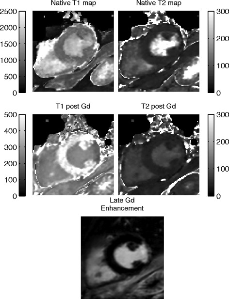 Figure 15