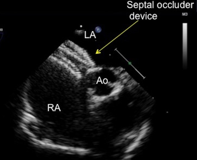 Figure 23