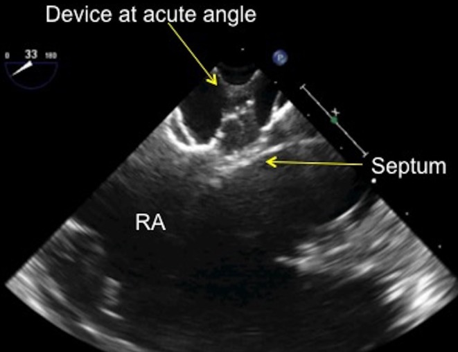 Figure 26