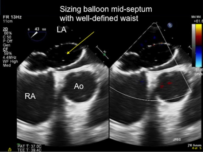 Figure 21