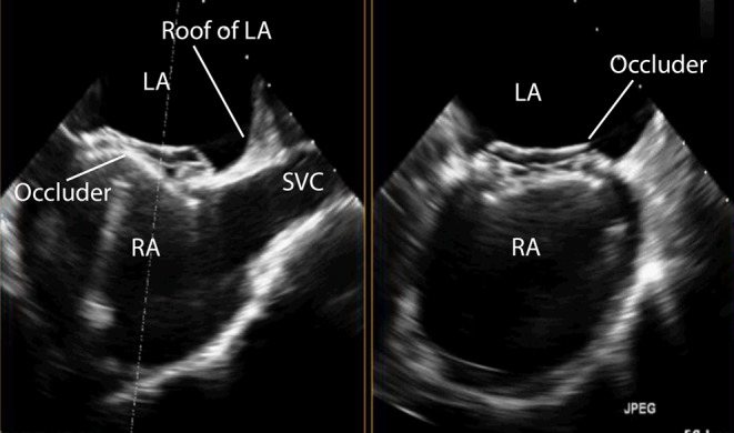 Figure 29