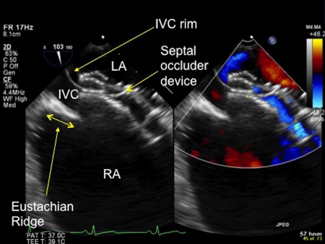 Figure 18