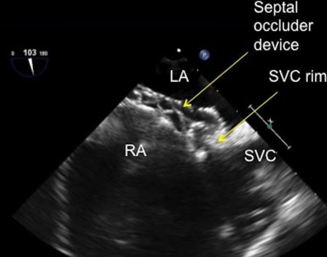 Figure 24