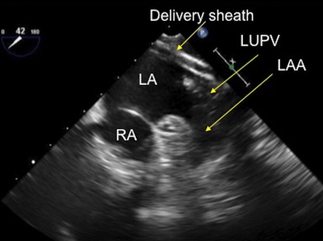 Figure 22