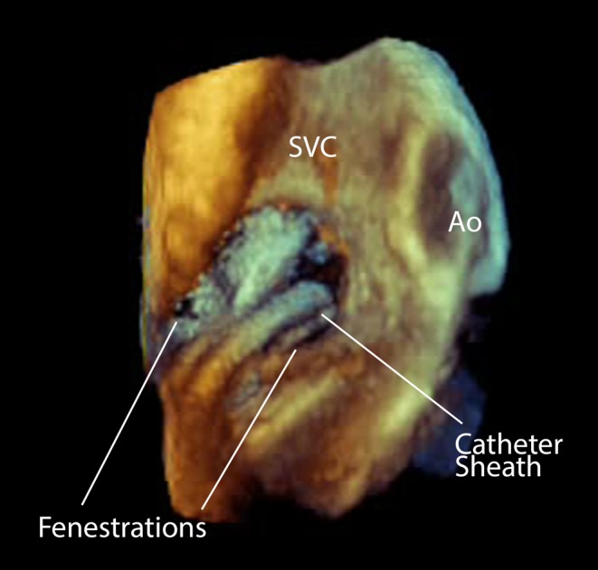 Figure 17