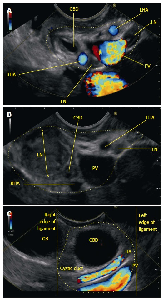 Figure 16