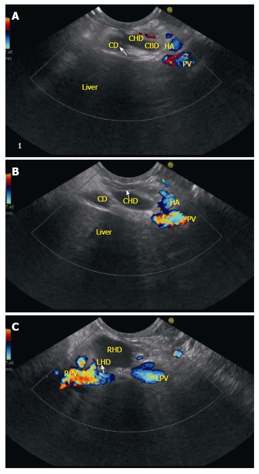 Figure 15