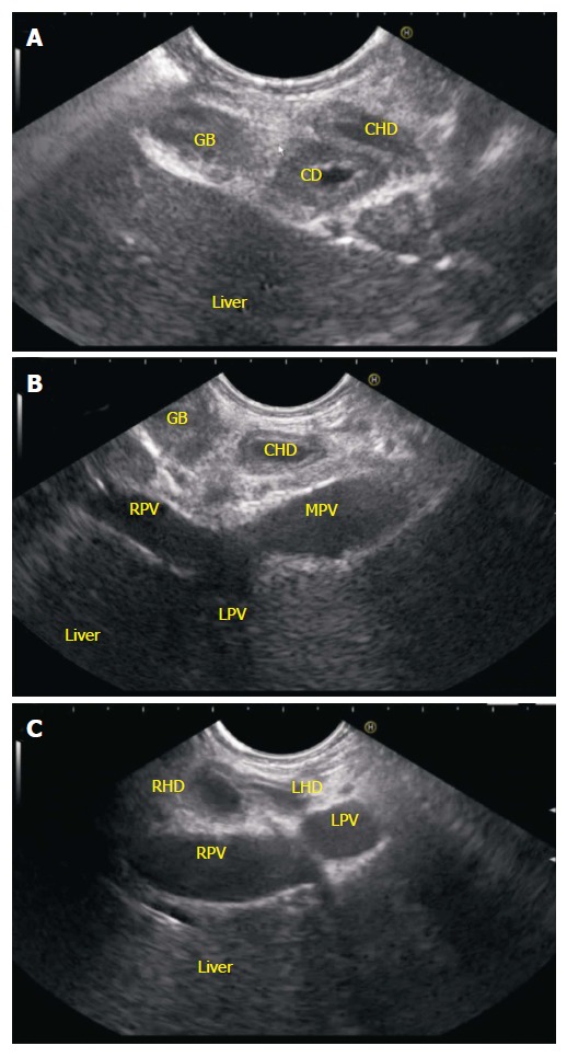 Figure 14