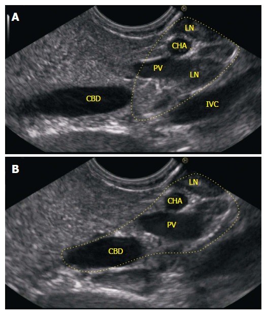 Figure 17