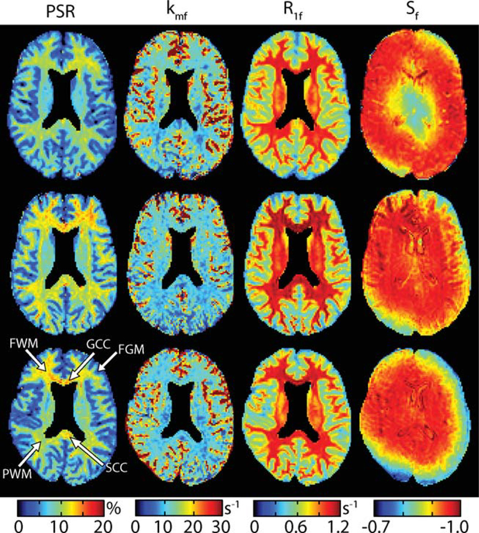 FIG. 3