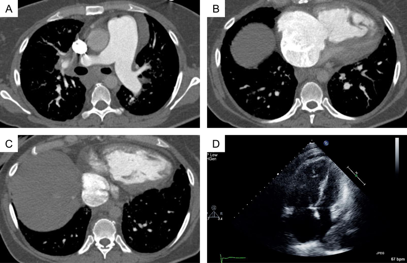 Figure 2. A-C: