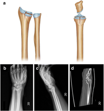 Fig. 5