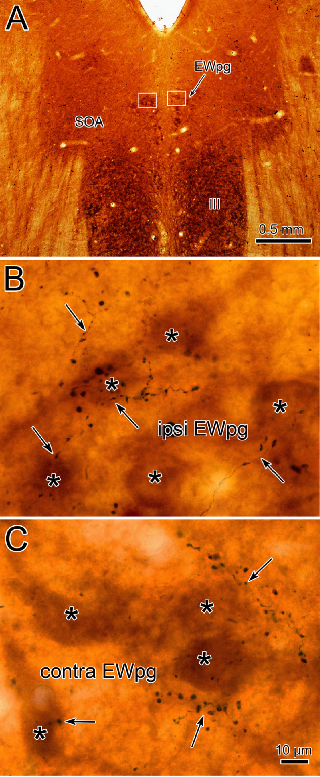 Figure 11.