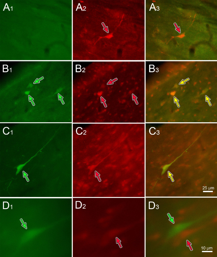 Figure 14.