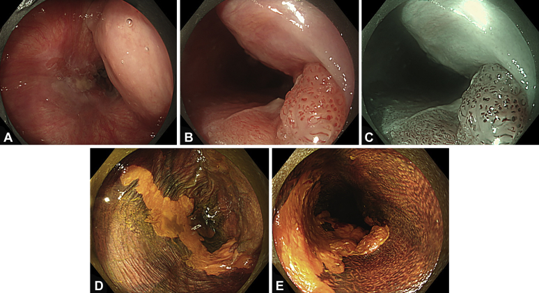 Figure 2