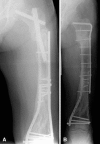 Fig. 3A–B