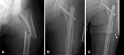 Fig. 1A–C