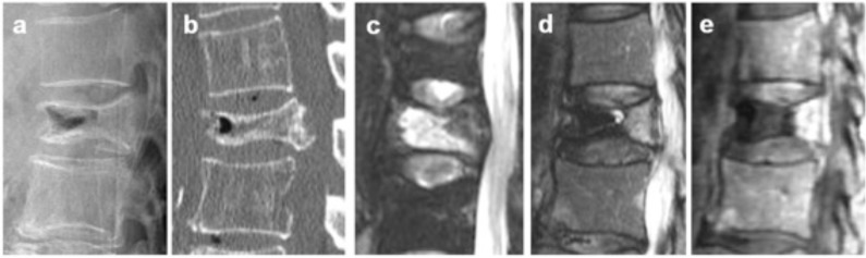 Fig. (1)