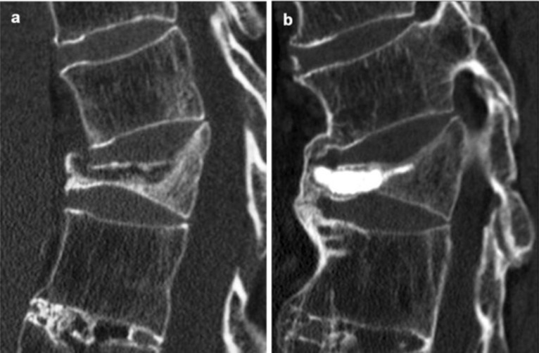 Fig. (4)