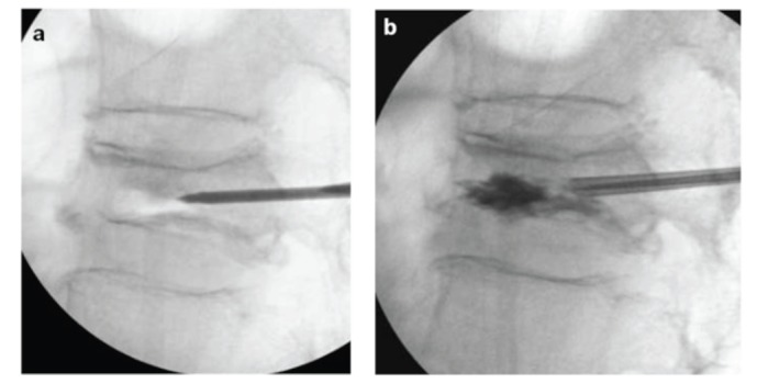 Fig. (2)