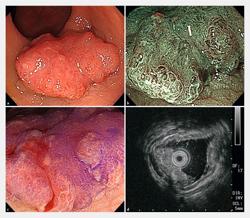 Fig. 1 a 